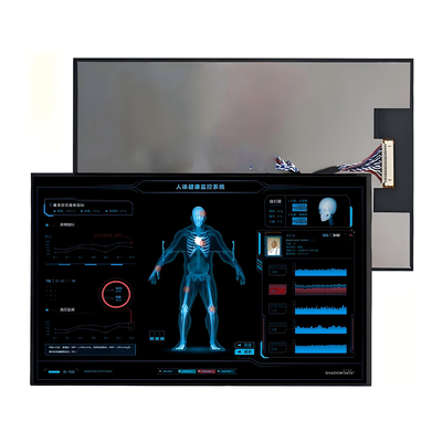 10Εικονική οθόνη LCD TFT.1-inch - Εικονική οθόνη υψηλής ανάλυσης για βιομηχανική και αυτοκινητοβιομηχανική χρήση